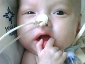 Com doença rara, bebê de 6 meses já teve mais de 200 paradas
cardíacas - foto 2