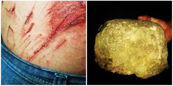 Atendimento só para o bandido… Vítima teve que voltar para casa sem nenhum band-aid