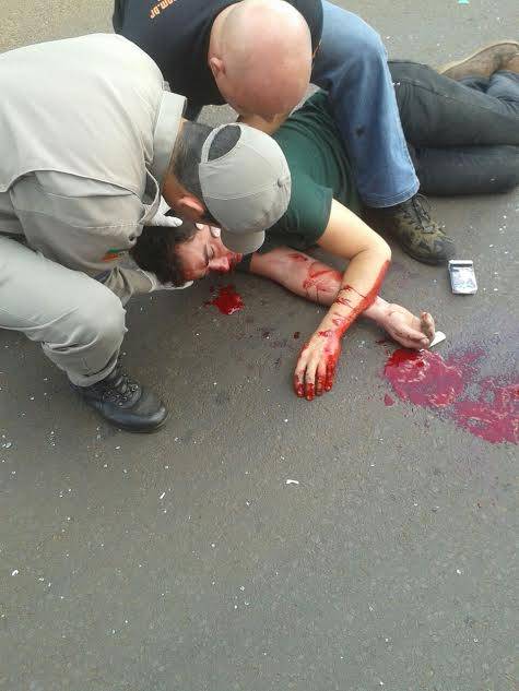 Motociclista fica gravemente ferido em acidente na cidade de Ijui - foto 2