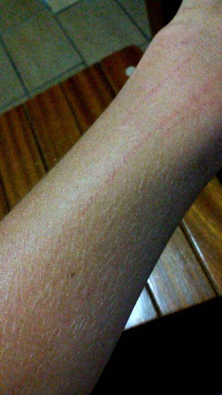 Professora é agredida por aluna em escola de Parobé - foto 3