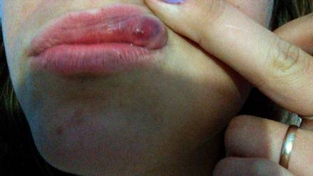 Professora é agredida por aluna em escola de Parobé - foto 2