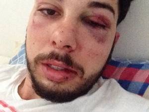 VÍDEO: família é agredida por PM e presa após som
alto em festa em SC - foto 3