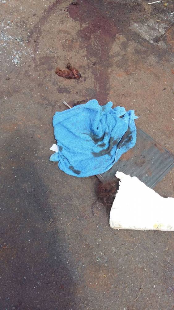 Grave acidente na BR 285 em São Luiz Gonzaga - foto 3