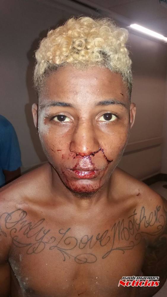 Bandidos trocam tiros com policiais da BM e são presos em Porto Alegre - foto 4