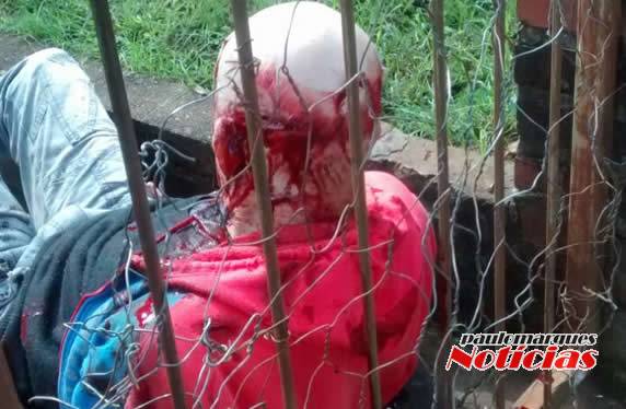 Homem é agredido com golpes de foice e facão em Ijuí - foto 2