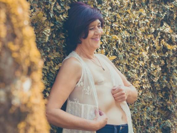 Mulheres exibem cicatrizes do câncer de mama em projeto fotográfico de SC - foto 3
