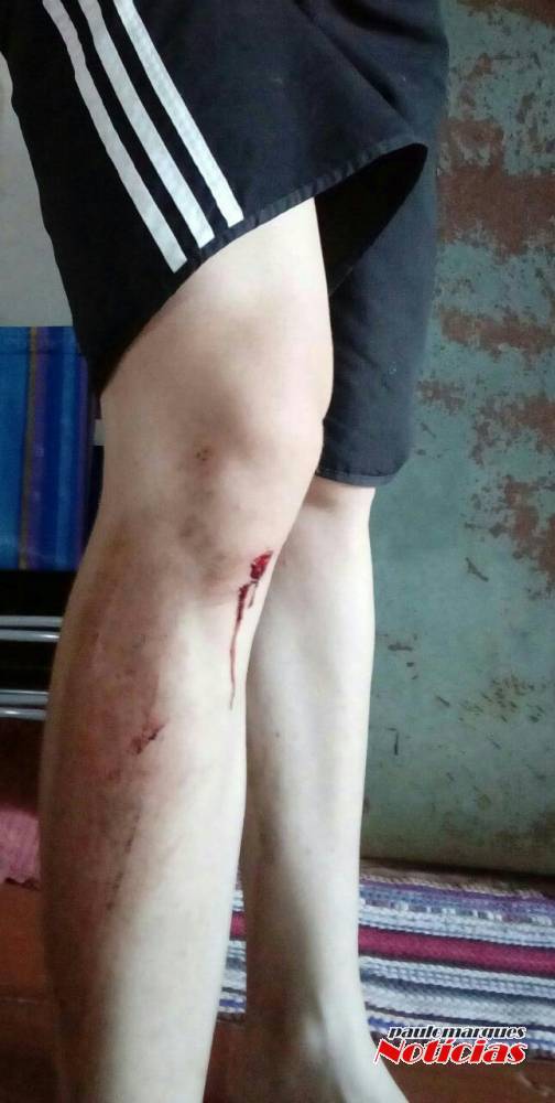 Lombadas físicas instaladas em Três de Maio geram reclamações e acidentes - foto 2
