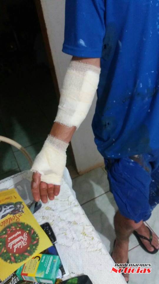 Lombadas físicas instaladas em Três de Maio geram reclamações e acidentes - foto 3