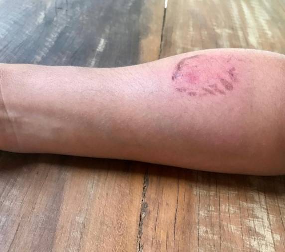 Soldado ainda foi agredida com socos e pontapés. Agressor estava sentado em rua, impedindo a saída de um ônibus
