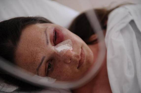 Vanessa Cavagnoli, 35 anos, está internada em Caxias do Sul. Acidente ocorreu na tarde desta terça-feira