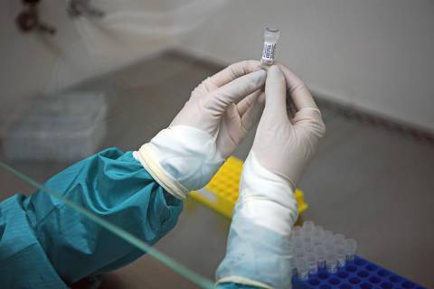 Um dos pacientes tinha 65 anos e histórico de doenças associadas, enquanto o outro tinha 80 anos e não registrava problemas crônicos de saúde