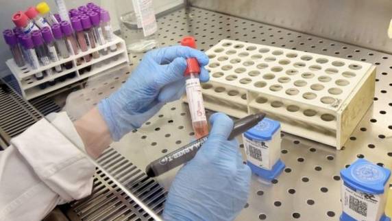 Nas últimas 24 horas, foram 4.588 novas ocorrências da doença