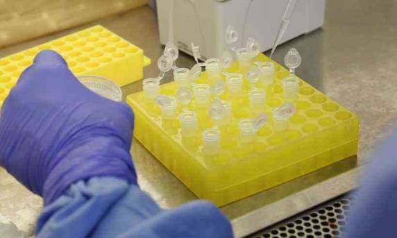 País já tem quase meio milhão de infectados desde o início da pandemia
