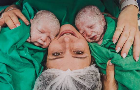 Gêmea ganha abraço de irmã logo após nascer em SC: ''Foi lindo'', diz mãe, que teve Covid na gestação - foto 2