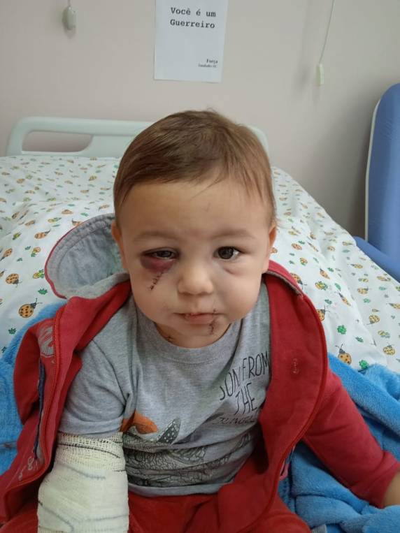 Menino de 1 ano e 8 meses foi levado em estado grave ao hospital, passou por cirurgia e, agora se recupera de ferimentos. Autor do atentado em Saudades que deixou 5 mortos recebeu alta da UTI.