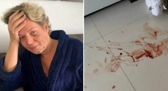 Deputada diz ter acordado no último domingo (18) no chão do seu apartamento funcional, em Brasília, no meio de uma poça de sangue