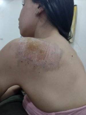 Caso está sendo investigado como importunação sexual e lesão corporal pela Polícia Civil; um dos suspeitos foi preso