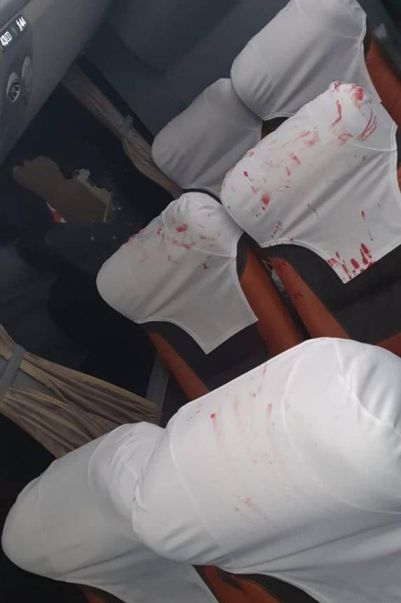 Ônibus do Bahia é atingido por bomba na Fonte Nova, e três jogadores ficam feridos - foto 3