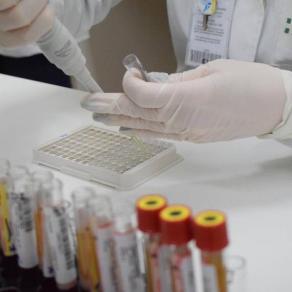 Paciente é morador de São Paulo, e identificação foi feita pelo Instituto Butantan