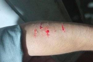 Um policial foi ferido em um dos braços por golpes de facão desferidos pelo homem