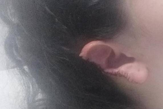 Ex-companheiro que não aceitava o fim do relacionamento invadiu a casa de mulher e arrancou metade do órgão com os dentes na quinta-feira (18), na zona sul da Capital