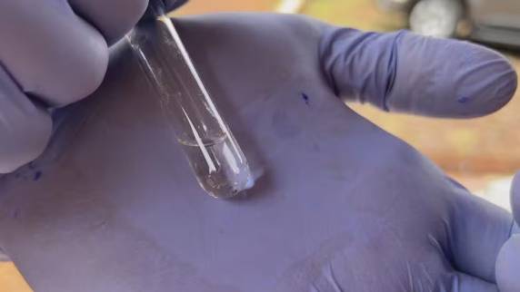 Em todo o ano passado, 54 pessoas morreram por causa da doença. Vítimas são homens de 58 e 66 anos. Eles residiam em São Leopoldo e Teutônia.