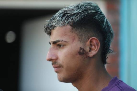 João Pedro Milgarejo, 17 anos, chegou a ser encaminhado a um hospital, com poucas escoriações, e recebeu alta na segunda-feira. Ele já está no município do sul do RS, onde pretende comparecer ao velório coletivo previsto para a tarde desta terça