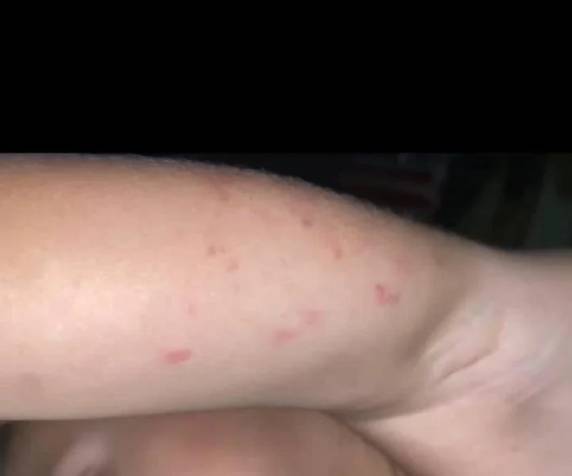 Família de menino de três anos registrou ocorrência após notar hematomas. Município diz que medidas administrativas já foram tomadas
